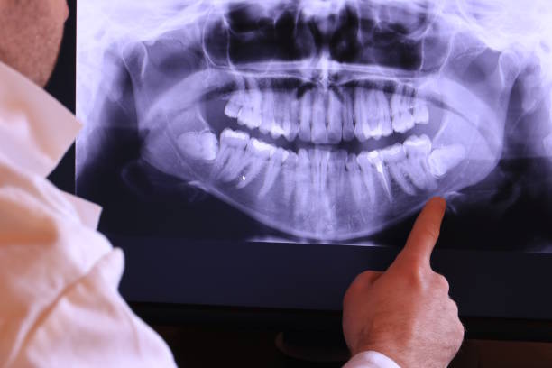 Best Emergency Tooth Extraction in St Marys, OH