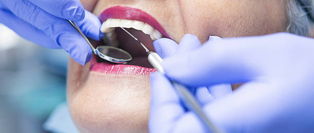 Best Emergency Dental Surgery in St Marys, OH